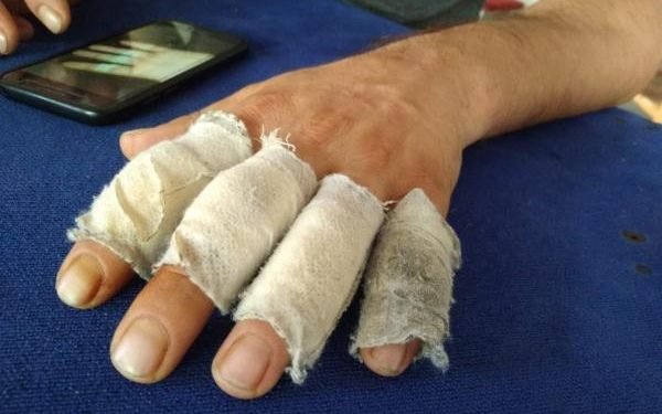 Elini Makinaya Kaptıran İşçi İşten Atıldı!