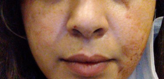 Müvekkilleriyle Görüşmek İstediler, İşkence Gördüler!