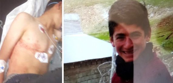 Van’da Askerlerin Vurduğu Çocuk Komada!