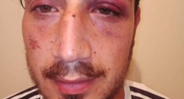 yemege_gittikleri_mekanda_polis_siddetine_maruz_kaldilar_h131770_5a772