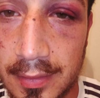 yemege_gittikleri_mekanda_polis_siddetine_maruz_kaldilar_h131770_5a772