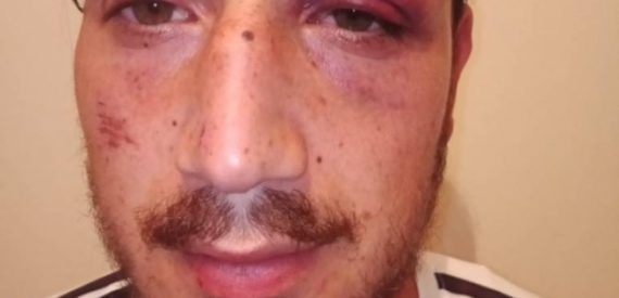 İşçiler Yemeğe Diye Gittiler, Polisin Saldırısına Uğradılar