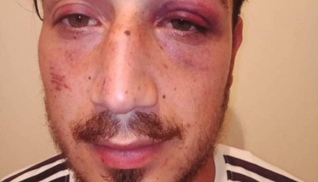 yemege_gittikleri_mekanda_polis_siddetine_maruz_kaldilar_h131770_5a772