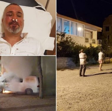 ÇGD, Yerel Basın Üzerindeki Baskıları Raporlaştırdı 4 gt1