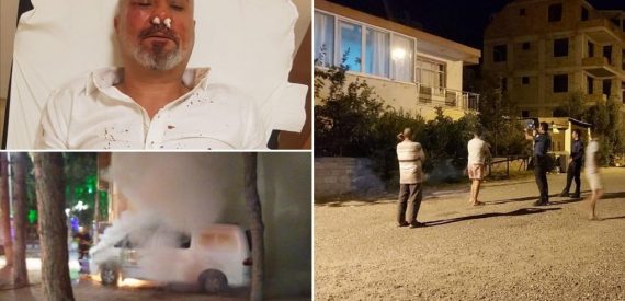 ÇGD, Yerel Basın Üzerindeki Baskıları Raporlaştırdı