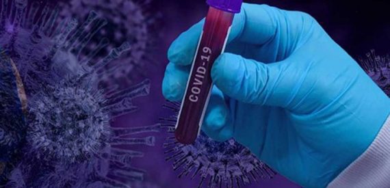 Düğünde Aynı Makyaj Malzemesini Kullandılar: 35 Kişiye Koronavirüs Bulaştı!