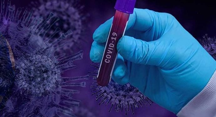 Düğünde Aynı Makyaj Malzemesini Kullandılar: 35 Kişiye Koronavirüs Bulaştı!