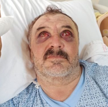 690x390cc-v-17-09-2020-iskence-foto-darp-servet-turgut