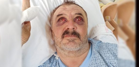 İşkenceye Suç Duyurusu: Askerler ‘Sizi Tararız’ Dedi