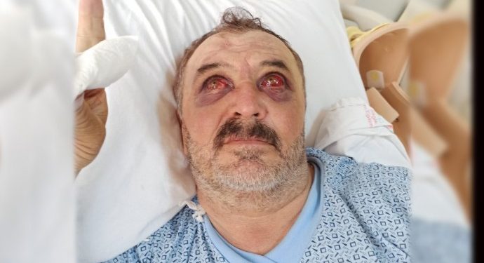 690x390cc-v-17-09-2020-iskence-foto-darp-servet-turgut