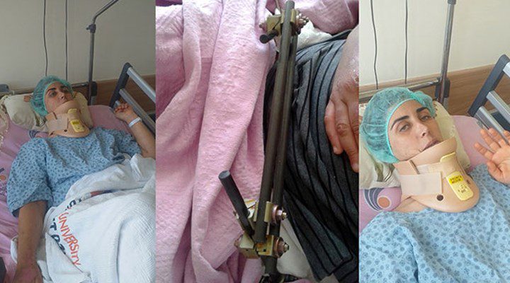 otomobil carpmasiyla agir yaralanan kadina arac hasar bedeli davasi 850748 5