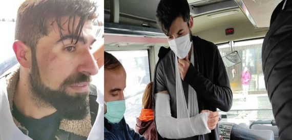 Polis, Migros İşçilerini Darp Etti: Bir İşçinin Kolunu Kırdılar