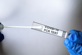 PCR test to COVID-19 in doctor hands, coronavirus swab collection kit close-up