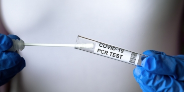 PCR test to COVID-19 in doctor hands, coronavirus swab collection kit close-up