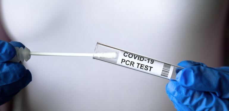 PCR test to COVID-19 in doctor hands, coronavirus swab collection kit close-up
