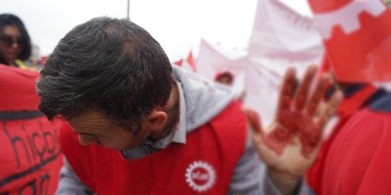 Ankara’da Polis Terörü: Kafamıza Telsizlerle Vurup Kafamızı Yardılar