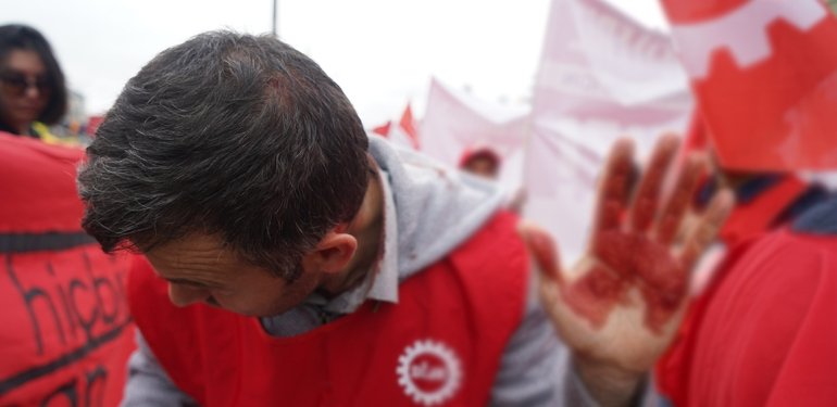 Ankara’da Polis Terörü: Kafamıza Telsizlerle Vurup Kafamızı Yardılar