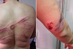 Sermaye Devletinin Utanç Davalarından Biri: Kaba Dayak, Askı, Elektrik.... 3 thumbnail