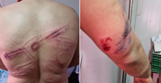 Hatay’da ÇHD’den İşkenceye Suçüstü: İşkence Olağan Hale Getirilmeye Çalışılmaktadır.