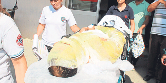 Demirçelik Ocağında Patlama: 4 İşçi Yaralandı