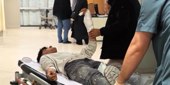 Bursa’da Çocuk İşçi Ağır Yaralandı