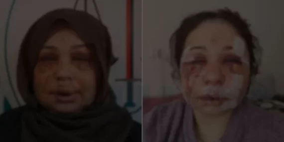 Polis, Boşanmak İsteyen Eşini Hastanelik Etti, İfade Verip Serbest Kaldı