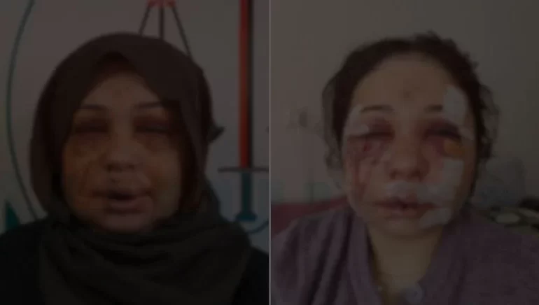 Polis, Boşanmak İsteyen Eşini Hastanelik Etti, İfade Verip Serbest Kaldı