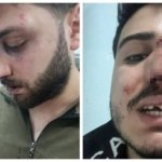 Trafik Kuralına Uymayan Polisi Uyaran Gençlere İşkence 14 genclere-polis-siddeti-kolaj-blur