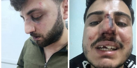 genclere-polis-siddeti-kolaj-blur