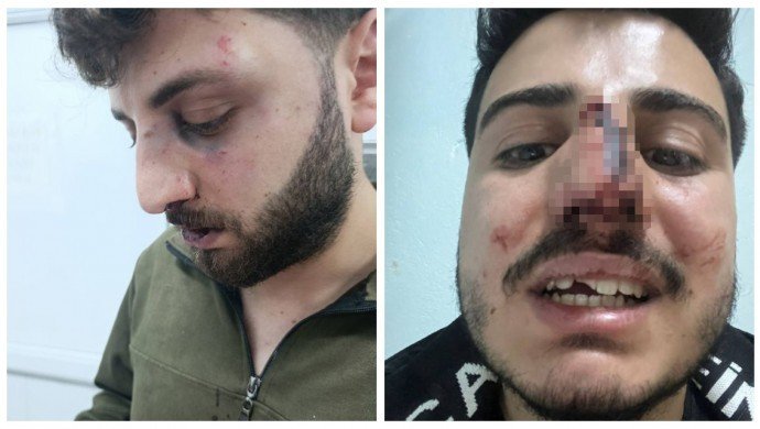 genclere-polis-siddeti-kolaj-blur